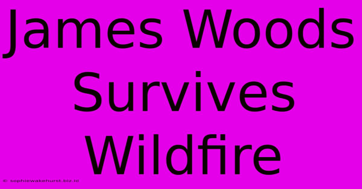 James Woods Survives Wildfire